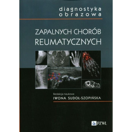 Diagnostyka obrazowa zapalnych chorób..