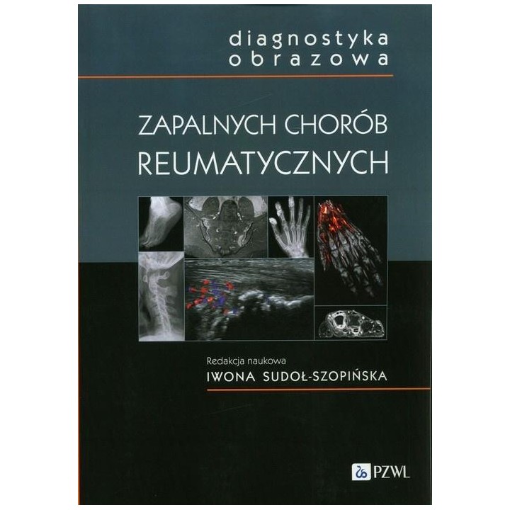 Diagnostyka obrazowa zapalnych chorób..