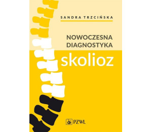 Nowoczesna diagnostyka skolioz