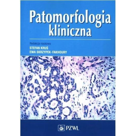 Patomorfologia kliniczna