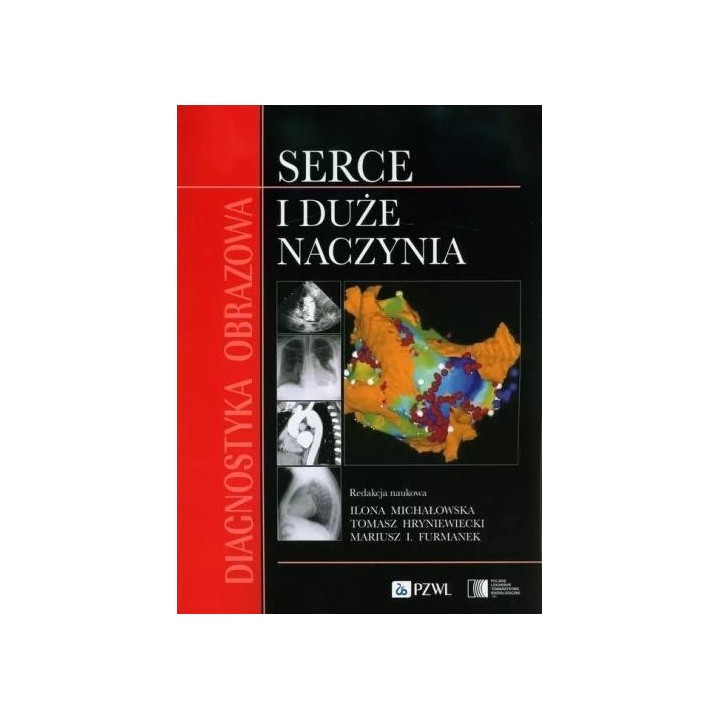 Diagnostyka obrazowa Serce i duże naczynia