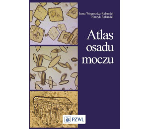 Atlas osadu moczu