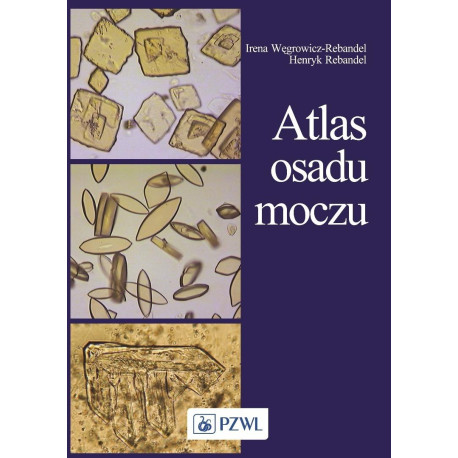 Atlas osadu moczu