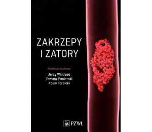 Zakrzepy i zatory