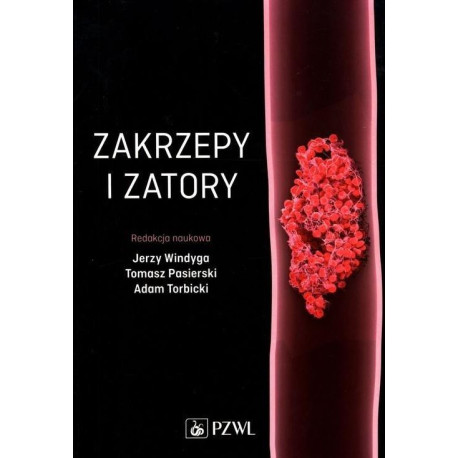 Zakrzepy i zatory