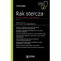 Rak stercza. Współczesne spojrzenie