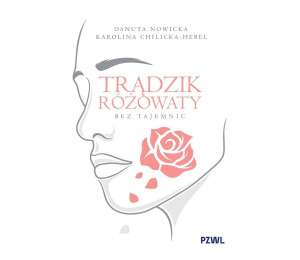 Trądzik różowaty bez tajemnic