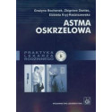 Astma oskrzelowa