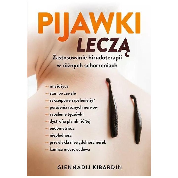 Pijawki leczą. Zastosowanie hirudoterapii...