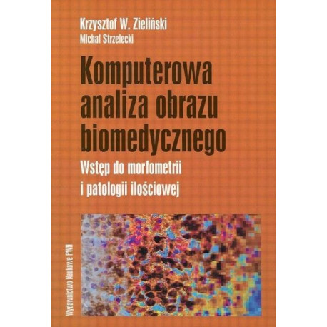 Komputerowa analiza obrazu biomedycznego