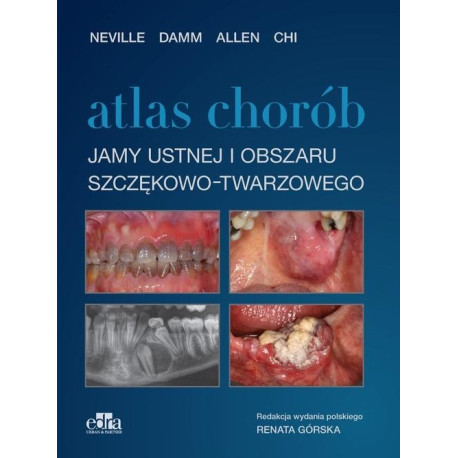 Atlas chorób jamy ustnej i obszaru szczękowo..