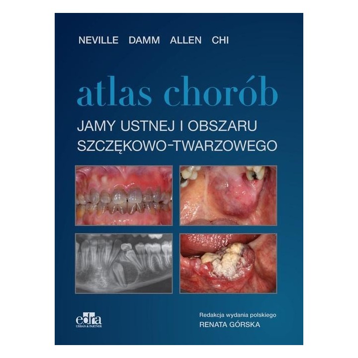 Atlas chorób jamy ustnej i obszaru szczękowo..