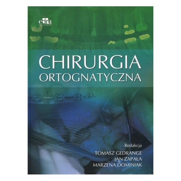 Chirurgia ortognatyczna