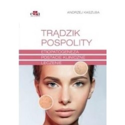 Trądzik pospolity. Etiopatogeneza. Postacie...