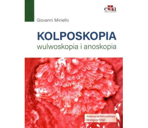 Kolposkopia, wulwoskopia i anoskopia