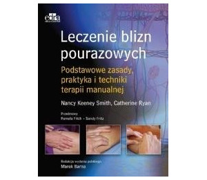 Leczenie blizn pourazowych