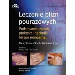 Leczenie blizn pourazowych
