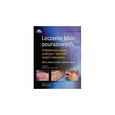 Leczenie blizn pourazowych