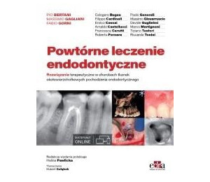Powtórne leczenie endodontyczne