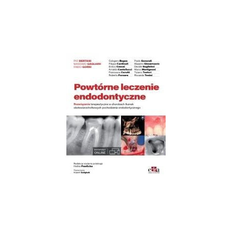 Powtórne leczenie endodontyczne