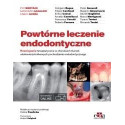 Powtórne leczenie endodontyczne