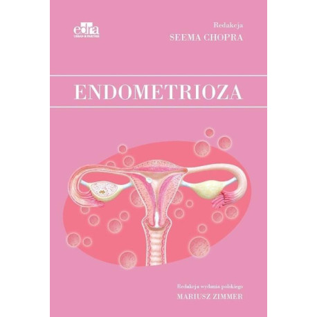 Endometrioza