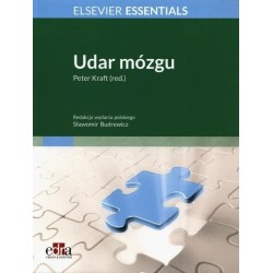 Udar mózgu