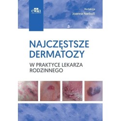 Najczęstsze dermatozy w praktyce lekarza rodzinn.