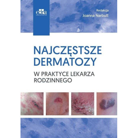 Najczęstsze dermatozy w praktyce lekarza rodzinn.