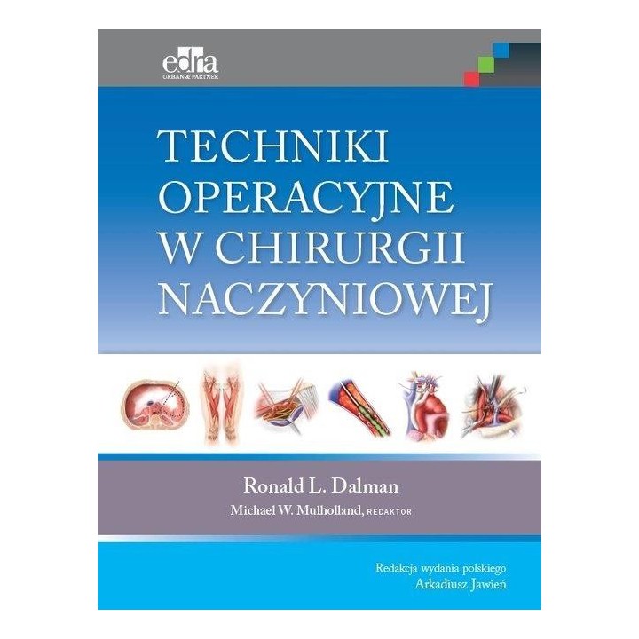 Techniki operacyjne w chirurgii naczyniowej