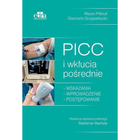 PICC i wkłucia pośrednie