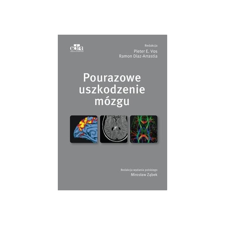 Pourazowe uszkodzenie mózgu