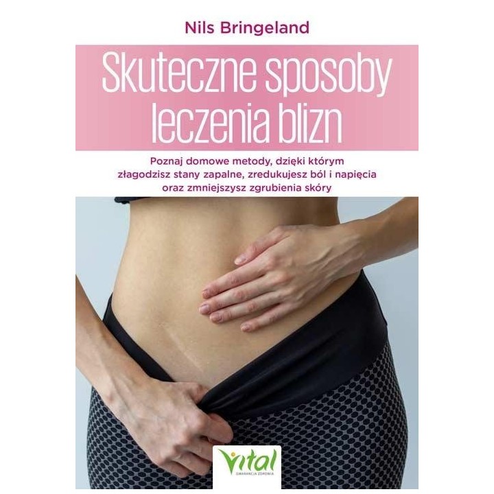 Skuteczne sposoby leczenia blizn