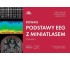 Podstawy EEG z miniatlasem wyd.3