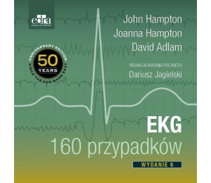 EKG 160 przypadków