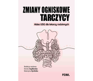 Zmiany ogniskowe tarczycy. Atlas USG dla lekarzy..