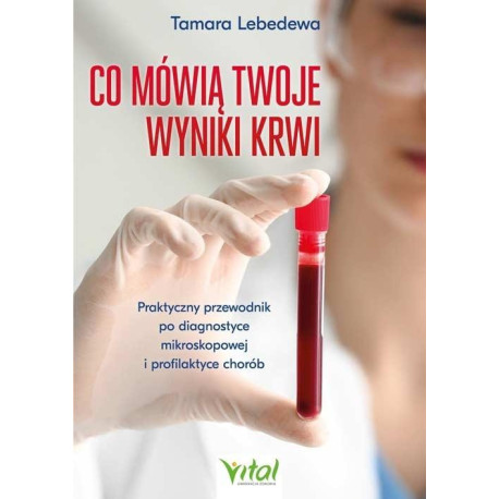 Co mówią twoje wyniki krwi