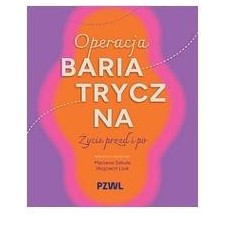 Operacja bariatryczna. Życie przed i po