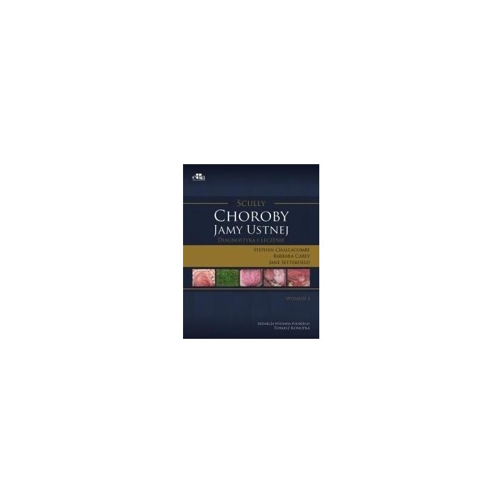 Scully. Choroby jamy ustnej