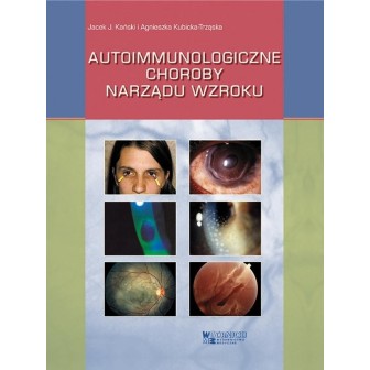 Autoimmunologiczne choroby narządu wzroku