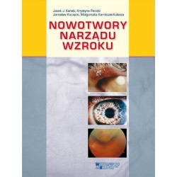 Nowotwory narządu wzroku