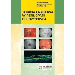 Terapia laserowa w retinopatii cukrzycowej