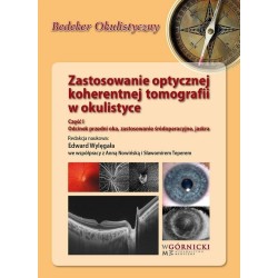 Zastosowanie optycznej koherentnej tomografii cz.1