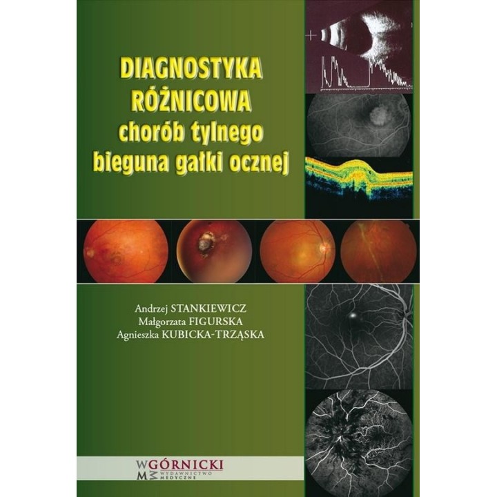 Diagnostyka różnicowa chorób tylnego bieguna...