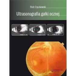 Ultrasonografia gałki ocznej