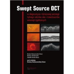 Swept Source OCT w diagnostyce patologii tylnego..
