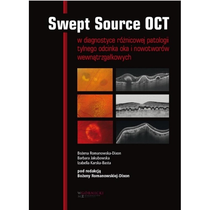 Swept Source OCT w diagnostyce patologii tylnego..