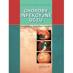 Choroby infekcyjne oczu. Kompendium diagnostyki...
