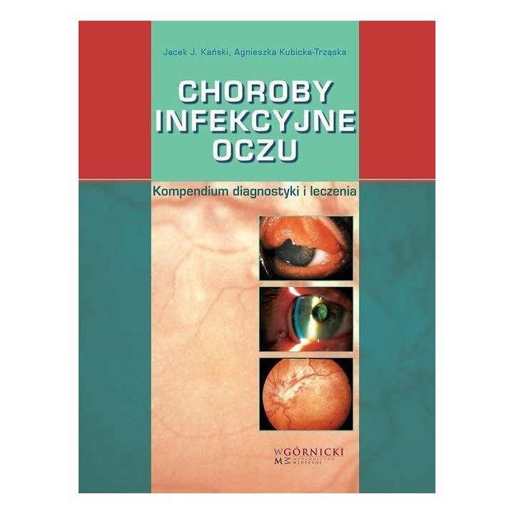 Choroby infekcyjne oczu. Kompendium diagnostyki...