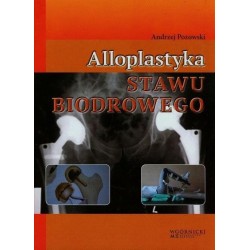 Alloplastyka stawu biodrowego